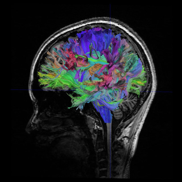 ヒト脳の神経線維走行